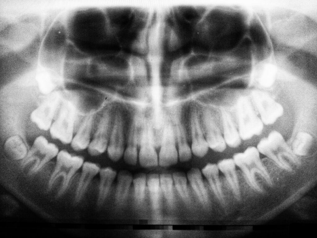 Photo Tooth scan
